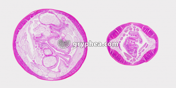 Ascaris du Cheval - ver parasite - femelle et mâle en CT x7 - gryphea.com